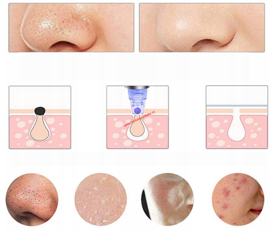 Vakuový čistič pleti XN-8030